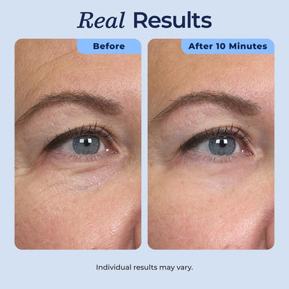 InstantLift Eye Serum